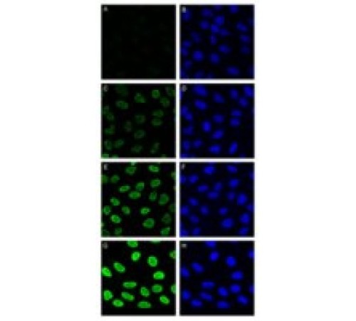 Неокарзиностатин из Streptomyces carzinostaticus 90% (SDS-PAGE), ~ 0,5 мкг / мл Sigma N9162